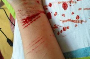 自残图片真实照片大全,真实照片背后的心理困境